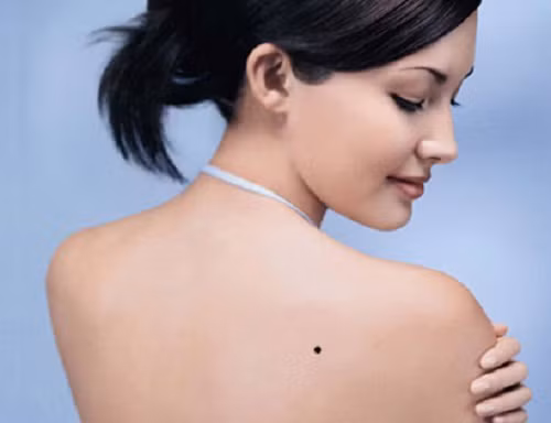  Nốt ruồi mọc dưới cùng xương bả vai phải, gần tiếp giáp với cột sống là người hưởng phú quý giàu sang. Họ gặp nhiều may mắn trong kinh doanh.