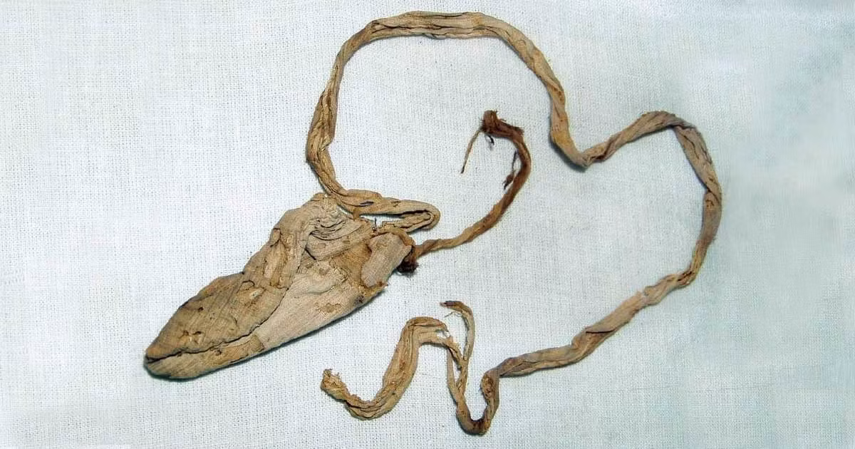 Theo các chuyên gia, "bảo bối" tránh thai tìm thấy trong lăng mộ có dấu vết ADN của pharaoh Tutankhamun.