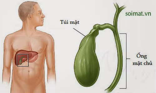 Triệu chứng âm thầm báo hiệu bệnh ung thư túi mật Trieu chung am tham bao hieu benh ung thu tui mat