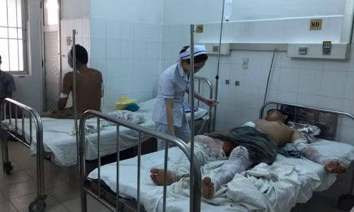 8 người bỏng nặng do bếp cồn bùng cháy tại tiệc cưới 8 nguoi bong nang do bep con bung chay tai tiec cuoi