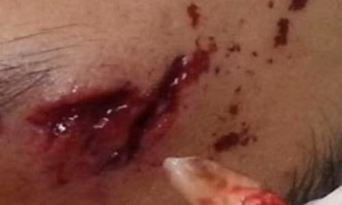 Hai hung rang nanh cam trong tran sau khi va cham xe