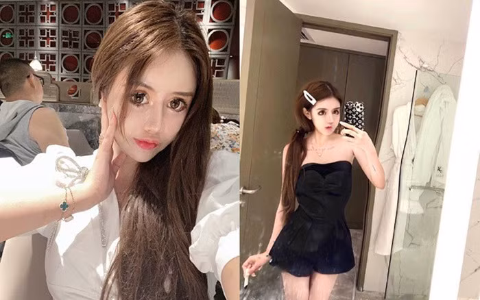 Dù chịu nhiều biến chứng, Tiểu Z từng nói cô không hối hận và vẫn muốn tiếp tục chỉnh sửa nhan sắc trong tương lai. Ảnh: Internet.