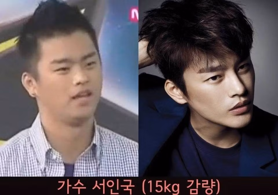 Seo In Guk của phim Reply 1997 cũng từng có thời điểm nặng gần 90kg và luôn cố nôn tất cả những gì mình ăn nhằm giảm cân. Sau khi nhận ra mình đã làm hại sức khỏe bản thân đến nhường nào, Seo In Guk bắt đầu điều chỉnh chế độ ăn hợp lý hơn và tích cực tập luyện. Sau 6 tháng, nam diễn viên đã giảm được 15kg.