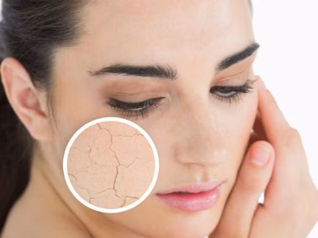 Da bị khô: Khi da bạn trở nên khô hơn bình thường, hãy quan tâm hơn đến dinh dưỡng bạn nhé, đây có thể do bạn đang bị thiếu canxi và vitamin đấy, hãy tìm cách bổ sung ngay nhé.