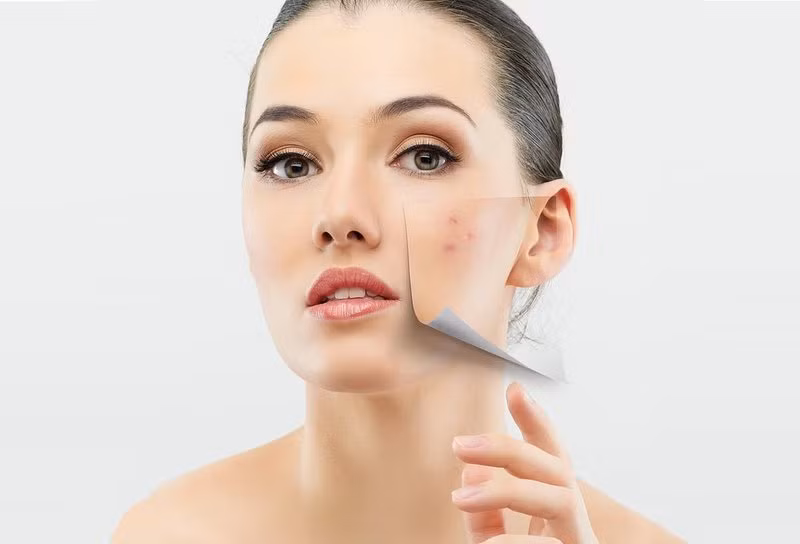 Tốt cho da: Một số nghiên cứu chỉ ra rằng các hormone tiêm vào động vật trước khi tiêu thụ có thể ảnh hưởng đến làn da của con người bằng cách gây ra các vấn đề như mụn trứng cá, trứng cá đỏ, chàm... Chuyển sang chế độ ăn nhiều rau xanh giúp bạn có một làn da khỏe mạnh bởi rau quả rất giàu chất chống oxy hóa và chất xơ.