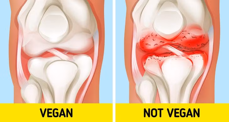 4. Các khớp của bạn ít bị viêm hơn: Thực phẩm như bơ, pho mát và bánh mì kẹp thịt có thể gây viêm khớp vì chúng chứa nhiều chất béo bão hòa. Nghiên cứu mới cho thấy chế độ ăn chay, đặc biệt là thuần chay, có thể giúp giảm các triệu chứng của bệnh viêm khớp dạng thấp. Điều này một phần là do bạn sẽ không ăn nhiều chất béo bão hòa, đồng thời ăn nhiều thức ăn thực sự chống lại chứng viêm.