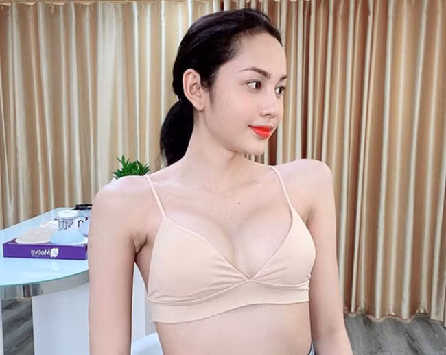 Câu chuyện về hành trình phẫu thuật chuyển giới của Lương Mỹ Kỳ từng được dân mạng chia sẻ rộng rãi.