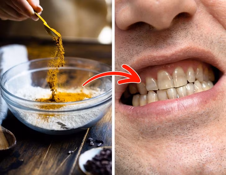 Ăn nhiều gia vị: Nêm gia vị vào thức ăn sẽ tăng thêm hương vị và nhiều mùi thơm khác nhau cho món ăn nhưng cũng có thể khiến răng bị ố vàng. Một số loại gia vị có sắc tố cao như cà ri có thể làm răng ngả sang màu hơi vàng. Nếu muốn thêm hương vị cho các món ăn, hãy thử dùng các loại thảo mộc như nghệ, cỏ xạ hương, quế... để bảo vệ sức khoẻ răng miệng.