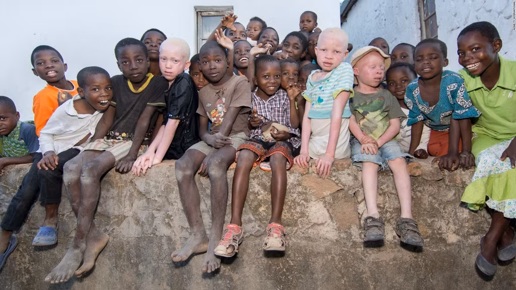 Trong số này đáng sợ và hãi hùng nhất là chuyện xảy ra ở Tanzania. Các pháp sư, thầy phù thủy lợi dụng sự thiếu hiểu biết và mê tín của người dân để thúc đẩy niềm tin mù quáng.