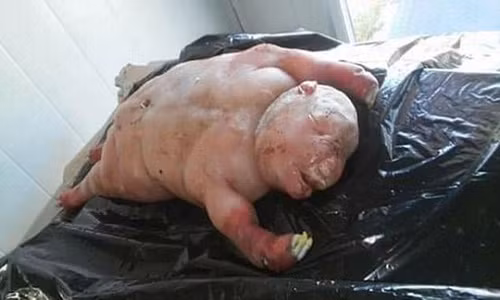 Cừu đẻ ra "quái vật nửa người nửa thú" gây sốc nặng Cuu de ra "quai vat nua nguoi nua thu" gay soc nang