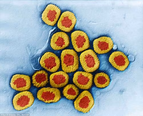  Vi rút bệnh đậu mùa. Bệnh đậu mùa do vi rút đậu mùa Variola virus gây nên. Đây là bệnh lây qua đường hô hấp và là nguyên nhân gây ra cái chết cho 300-500 triệu người trong thế kỷ 20. Vi rút đậu mùa có kích thước tới 300 micromet. Ở ngoài môi trường thời tiết khô hanh, vi rút sống được rất lâu, từ 3 đến 17 tháng. 