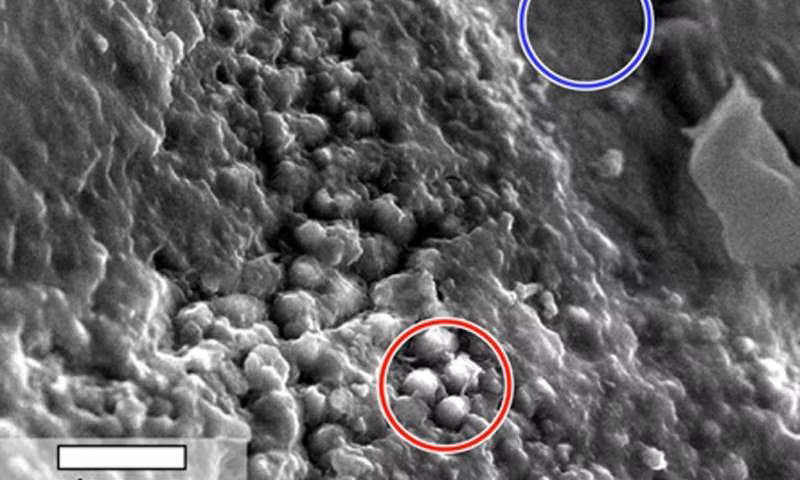  Kính hiển vi này chính là Atmospheric or environmental scanning electron microscope (gọi tắt là ASEM hoặc ESEM), một thiết bị mới do NASA đang ấp ủ chế tạo. 