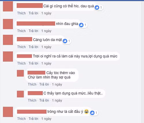 Rùng mình dịch vụ... cắt bỏ da đầu để sửa trán bớt cao - Hình 5 Rung minh dich vu... cat bo da dau de sua tran bot cao-Hinh-5
