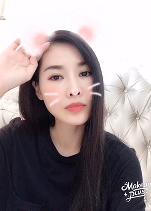 Quế Vân đã trải qua quá trình hạ gò má, gọt hàm, mở khóe mắt, hút mỡ má.