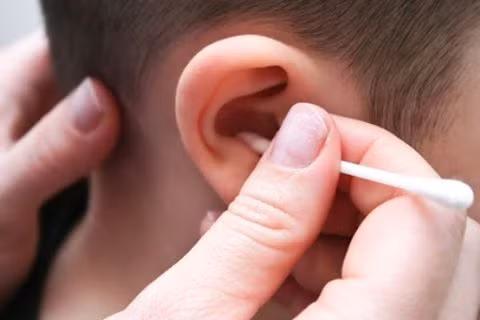 Ngày nào cũng lấy ráy tai. Một trong những sai lầm khi lấy ráy tai khổ biến nhất là ngoáy tai hàng ngày. Theo quy luật tự nhiên, ráy tai sẽ từ từ tự thoát ra bên ngoài, cuốn theo nhiều mầm bệnh và tế bào da chết ra khỏi tai. Cụ thể, dưới tác động của các nhung mao trên bề mặt tế bào tuyến, ráy tai sẽ tự khô rồi bong ra, di chuyển theo chiều từ trong ra ngoài. Do vậy, bạn không cần thiết phải lấy ráy tai hàng ngày.