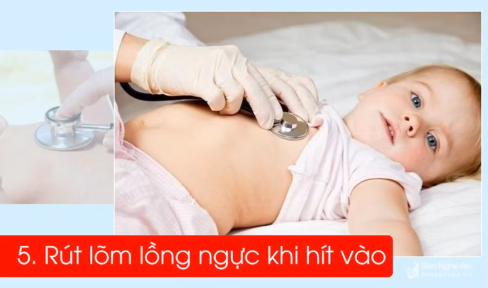 6 dau hieu ro ret nhat de phat hien tre bi viem phoi-Hinh-5