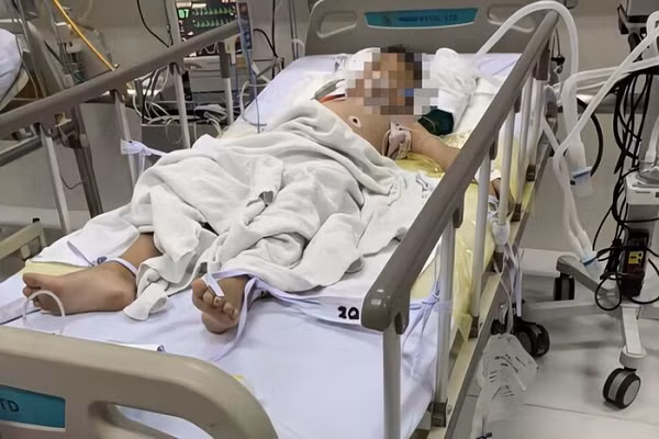 Trước đó vào tháng 11/2019, tại huyện Nhà Bè, TP Hồ Chí Minh bé trai Đ.T.K 7 tuổi cũng làm theo trò 'thắt cổ nhưng vẫn thở được' trên YouTube. Do được phát hiện và cấp cứu kịp thời nên bé K đã may mắn giữ được tính mạng.
