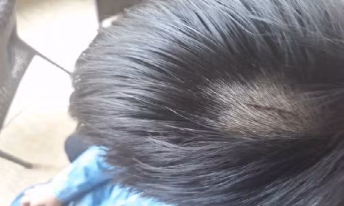 Co giao tran tinh viec dung thuoc danh 23 hoc sinh