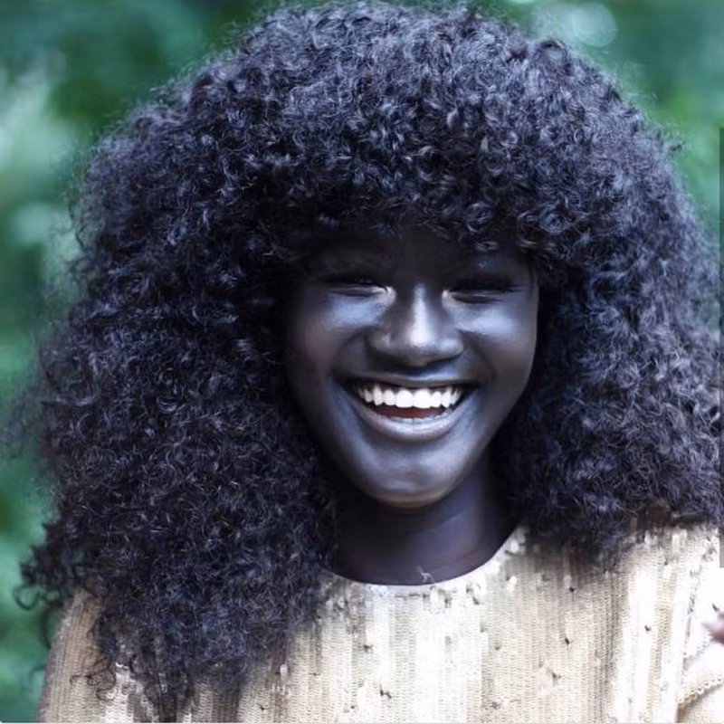 Khoudia Diop, 19 tuổi, là người Senegal (Tây Phi). Cô chinh phục cộng đồng mạng với nhiều bức ảnh tuyệt đẹp. Cô có 235.000 người theo dõi trên Instagram. Khoudia truyền cảm hứng cho những người có nét khác biệt khác. Cô nói: "Nếu bạn may mắn không giống những người khác, thì đừng bao giờ thay đổi".