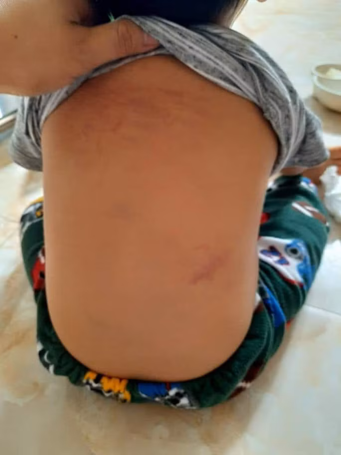 Thời điểm xảy ra vụ việc, lớp học có 2 giáo viên đứng lớp là cô Nguyễn Thị Phương Thảo (SN 1986), là người trực tiếp bạo hành cháu nhỏ, và cô Bùi Thị Mai (SN 1967), là người chứng kiến vụ việc. Trẻ mầm non 15 tháng tuổi bị bạo hành là con của anh T.V.H. và chị P.T.H. (ngụ xã Ninh Khang). Hiện, 2 cô giáo này đã bị đình chỉ dạy học. 