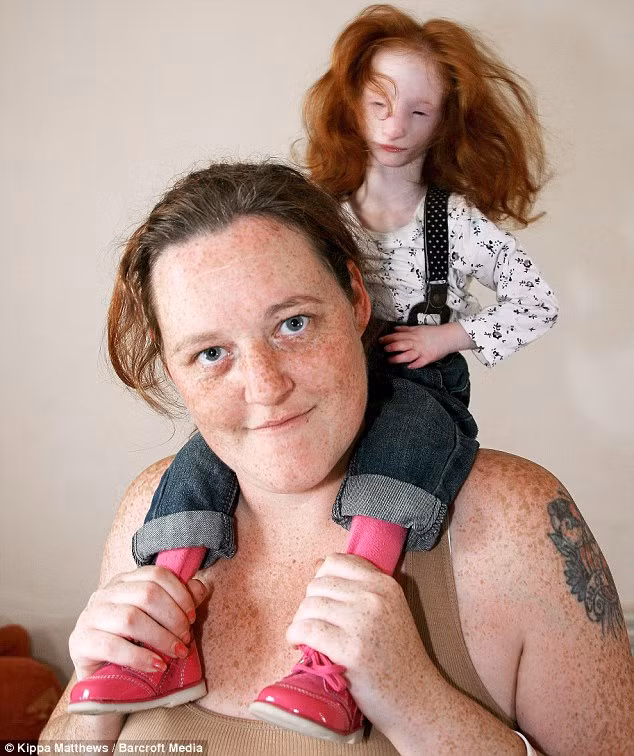 Charlotte Garside được mệnh danh là cô bé tý hon phiên bản thực tế bởi khi sinh ra vào năm 2007, cô bé chỉ nặng vỏn vẹn 9 lạng, phải mặc quần áo của búp bê. Các bác sĩ khi đó đã nói rằng cô bé sẽ không thể sống tới 1 tuổi. (Nguồn Sina)