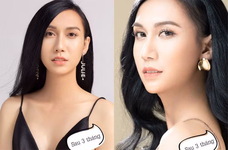 Sau ba tháng dao kéo, hình ảnh của Lynk Lee giờ thực sự là một cô gái xinh đẹp, quyến rũ.
