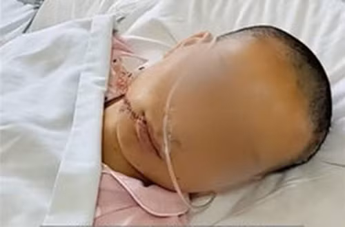 Chồng hành hung vợ đến liệt giường, suýt chết gây phẫn nộ Chong hanh hung vo den liet giuong, suyt chet gay phan no