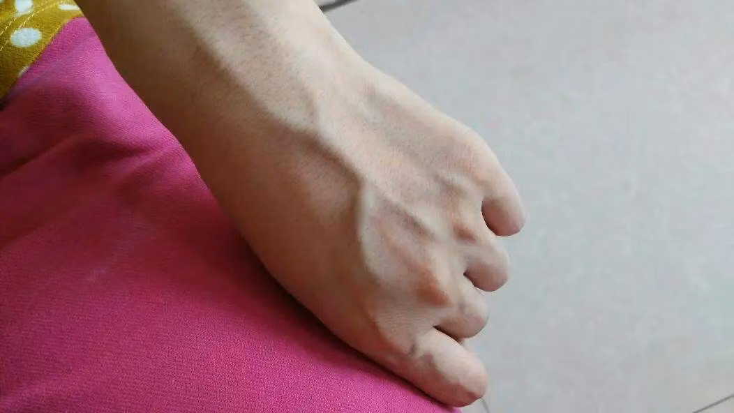 Nhin gan xanh noi cho nao doan ngay ra benh cho do