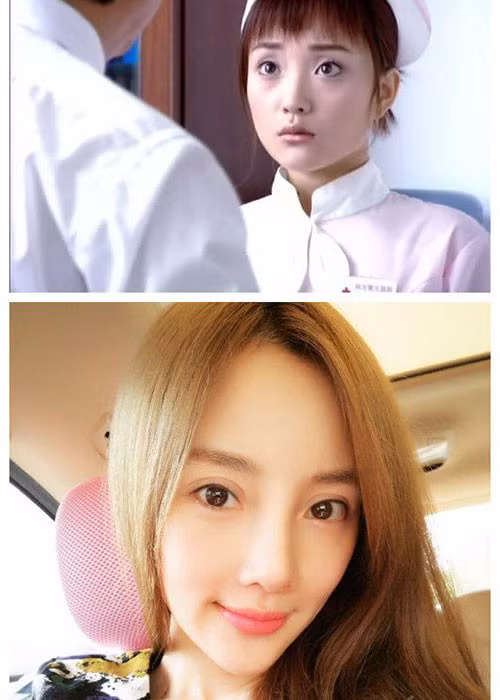 Lý Tiểu Lộ hiện bị ghét nhất trong showbiz Hoa ngữ. Ngoài scandal ngoại tình dẫn đến ly hôn, cô còn vướng lùm xùm dao kéo.
