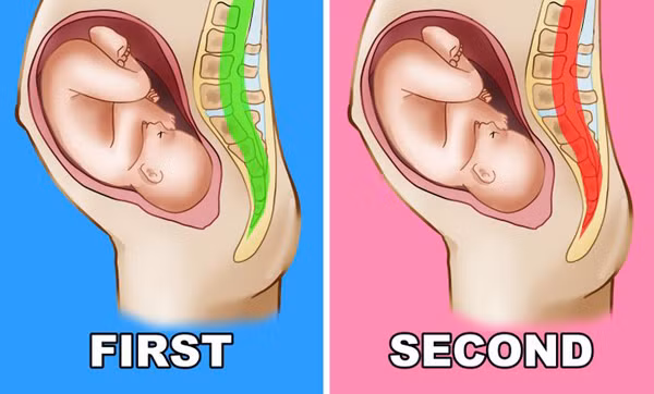 Nghiên cứu chỉ ra, mức độ đau do co thắt tử cung sau sinh sẽ ngày càng tăng ở những lần sinh sau. Người mẹ sẽ cảm nhận rõ ràng khi cho con bú. Do vậy nếu không thể chịu được, người mẹ nên thông báo với bác sĩ để có biện pháp cải thiện, giúp mẹ an tâm cho con bú.