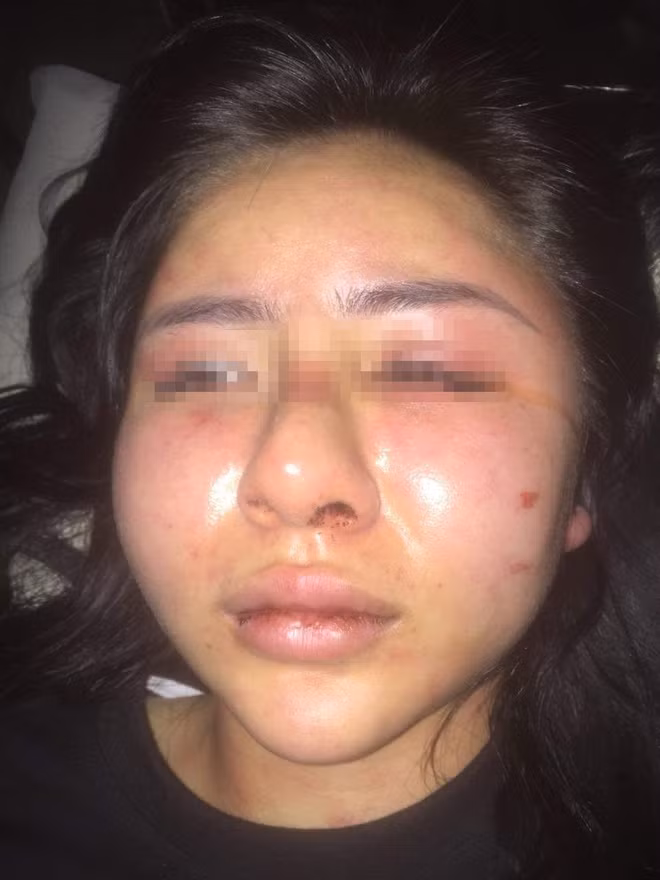 Ga trai danh co gai suot 2 gio doi mat hinh phat nao?