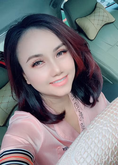 Trước sinh nhật của mình tháng 2 vừa qua, Hoàng Yến quyết định làm răng để tự tin hơn.