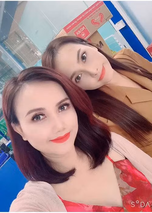 "Cô Xuyến" của "Những ngày không quên" thừa nhận chỉnh sửa gương mặt một chút nhưng chủ yếu là làm lại răng.