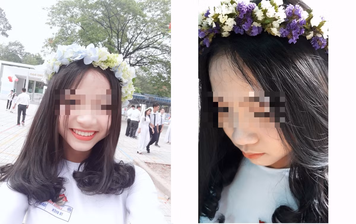 Nạn Uyên đang là sinh viên ĐH Khoa học Xã hội và Nhân văn (ĐH Quốc gia TP HCM).