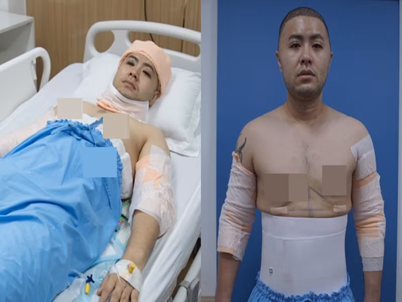Vì bị stress cực độ khi mỗi lần gặp khán giả đều bị chê mập, Akira Phan quyết định dao kéo. Nam ca sĩ "Mùa đông không lạnh" chi 300 triệu hút mỡ, cằm, cánh tay và sửa lại mí mắt. Ảnh: Dân Việt