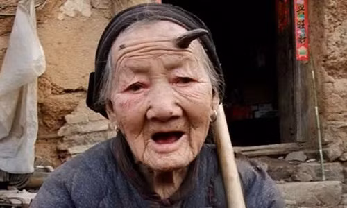 Chiếc sừng mọc ở người thường chứa hợp chất keratotic giống trong móng tay và tóc.