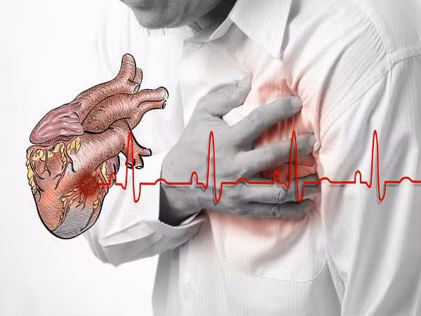 Hội chứng Brugada là một chứng rối loạn nhịp tim hiếm. Triệu chứng chính của hội chứng brugada là nhịp tim không đều và nếu không được điều trị thì có thể dẫn đến ngừng tim đột ngột.