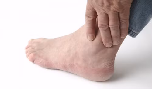 Khó vận động: Quá trình vận động của bệnh bị gián đoạn, rất khó vận động vì cơn đau buốt do xương khớp bị tổn thương viêm.