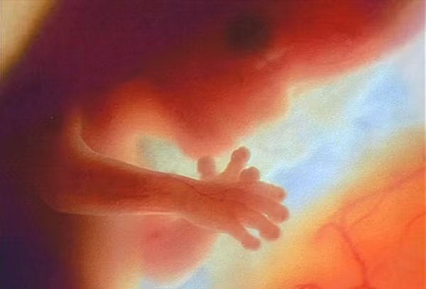 Tháng thứ 3, em bé dài khoảng 5cm và bắt đầu tự di chuyển. Bác sĩ có thể cho bạn nghe nhịp tim của em bé. Đồng thời, cơ quan sinh dục cũng trở nên rõ ràng.