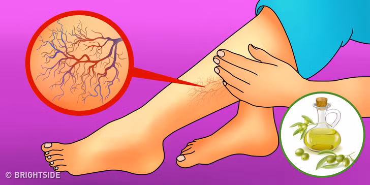 Dầu ô liu và vitamin E giúp giúp làn da mềm mại và đàn hồi.Trộn tỷ lệ bằng nhau của dầu ô liu và vitamin E. Hơ ấm trên lửa nhỏ rồi bôi trên da và massage trong một vài phút.