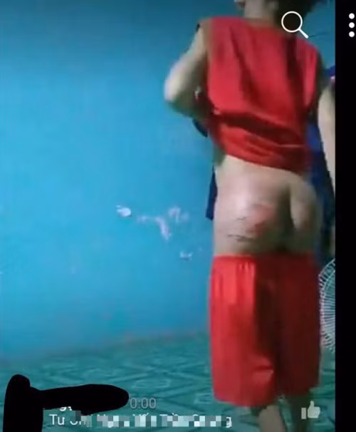Tiet lo kho tin vu chau be nghi bi “nguoi tinh cua me” sat hai