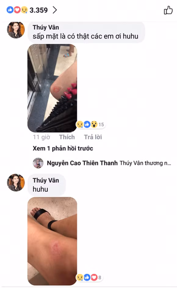 Thuý Vân viết về sự cố của mình trên sân khấu.