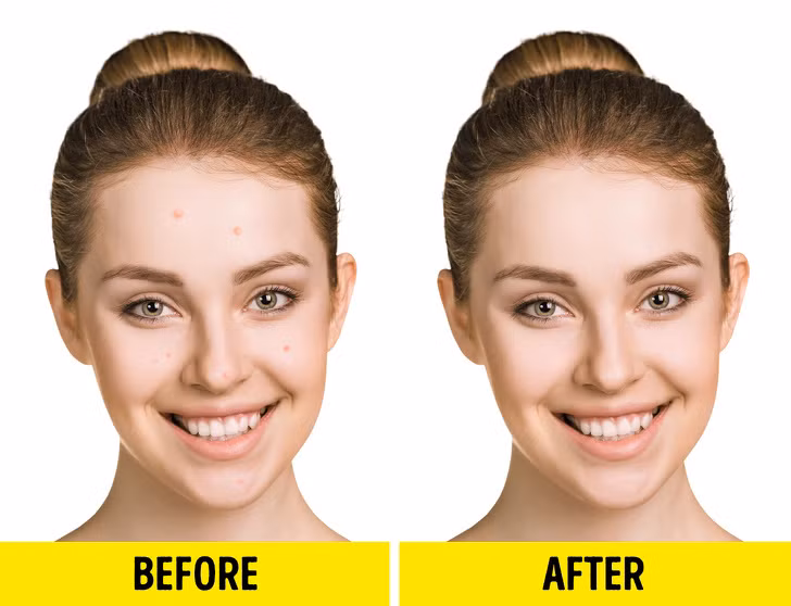 Giúp cải thiện làn da: Nhờ khả năng phục hồi màng tế bào, axit béo omega-3 cũng giúp sửa chữa các tế bào da bị tổn thương từ bên trong. Hiệu quả chống viêm mạnh giúp làm giảm mẩn đỏ và kích ứng và góp phần rất lớn vào vẻ đẹp làn da của bạn.