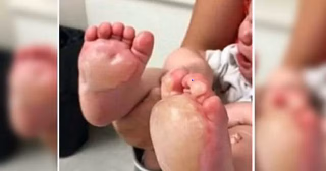 Gửi con cho người giữ trẻ để đi ra ngoài, người phụ nữ bàng hoàng khi trở về nhìn thấy chân con.