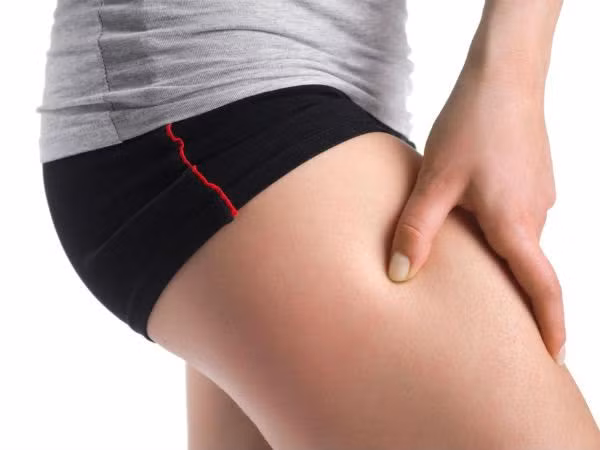 Việc tích mỡ ở đùi không chỉ làm giảm thẩm mỹ mà còn khiến trọng lượng cơ thể nặng nề, lâu dài sẽ có nguy cơ bệnh tật. Sau đây là 9 cách giúp chị em giảm mỡ đùi tại nhà vô cùng hiệu quả.