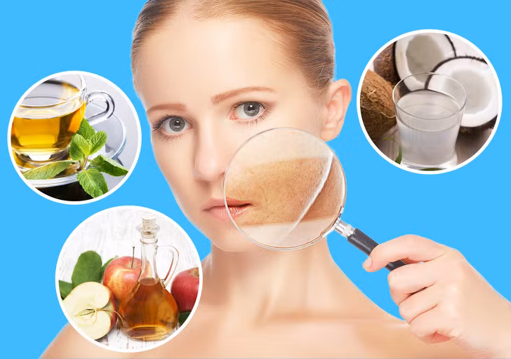 Dầu dừa cải thiện làn da bị cháy nắng. Bằng cách nhỏ 1 – 2 giọt dầu dừa lên vùng da bị bỏng rát thường xuyên sẽ làm mờ dần vết cháy nắng trên da.