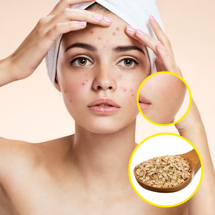 Bột yến mạch giúp làm sạch và giữ ẩm cho bệnh nhân bị viêm da, dị ứng, da khô và bệnh rosacea. Thêm một số yến mạch vào nước ấm trong bồn tắm để làm dịu da bị kích thích.