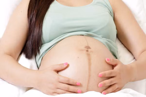 Đường sọc nâu chạy dọc dưới bụng:Từ tam cá nguyệt thứ hai trở đi, mẹ bầu bắt đầu thấy xuất hiện 1 đường thẳng sậm màu chạy giữa bụng dưới. Đường lằn bụng này hình thành do sự thay đổi nội tiết tố, khi cơ bụng căng ra và hơi tách biệt để tạo không gian lớn hơn cho em bé trong bụng.