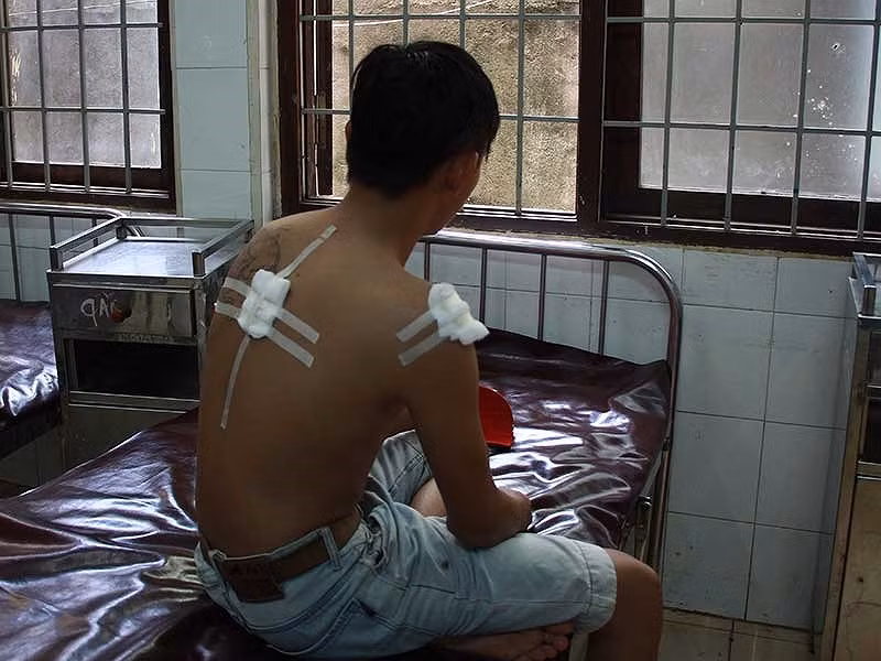 Một thanh niên bị công an xã Ea Kao, TP Buôn Ma Thuột bắn bị thương tối 16/6/2017. Ảnh: CTV.