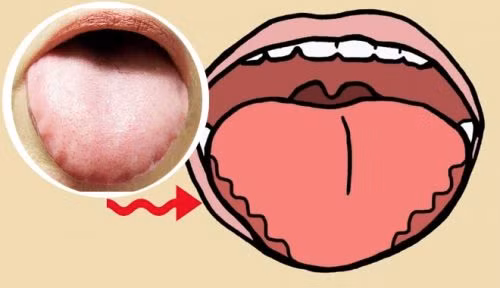 Lưỡi sẽ có màu tái nhợt có thể do cơ thể đang thiếu sắt. Lưỡi sẽ có màu tái nhợt có thể do cơ thể đang thiếu sắt.
